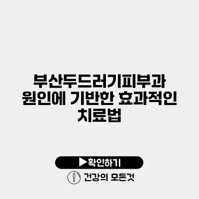 부산두드러기피부과 원인에 기반한 효과적인 치료법